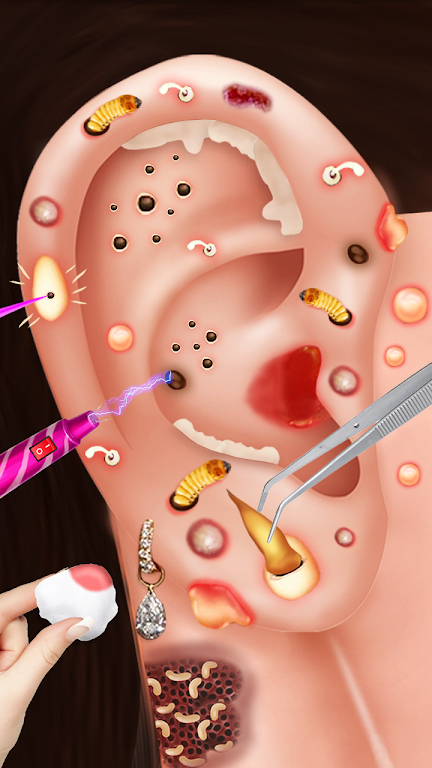 Ear Wax Salon:ASMR Doctor Game Schermafbeelding 1